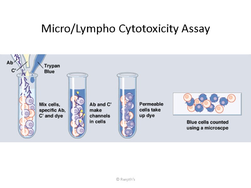 © Ranjith’s Micro/Lympho Cytotoxicity Assay